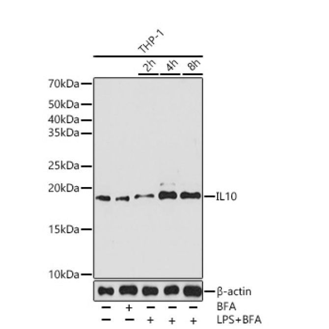 IL10 Rabbit Monoclonal Antibody