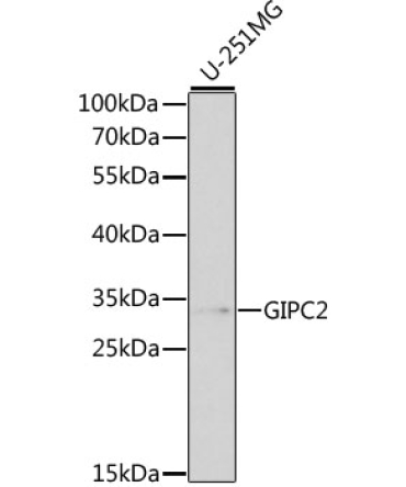 GIPC2 Rabbit Polyclonal Antibody