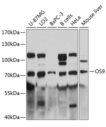 OS9 Rabbit Polyclonal Antibody