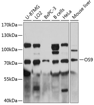 OS9 Rabbit Polyclonal Antibody