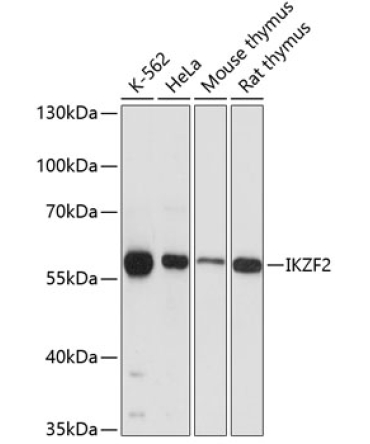 IKZF2 Rabbit Polyclonal Antibody