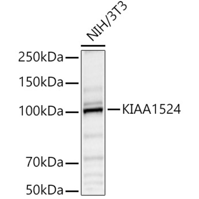 KIAA1524 Rabbit Polyclonal Antibody