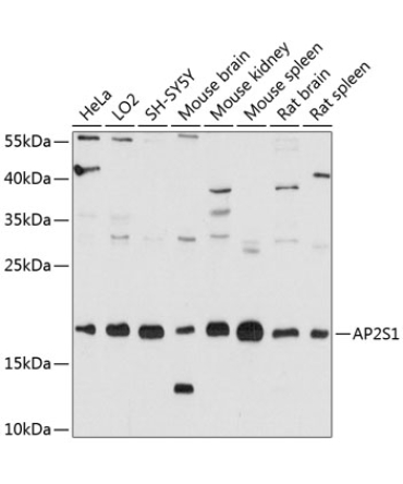 AP2S1 Rabbit Polyclonal Antibody