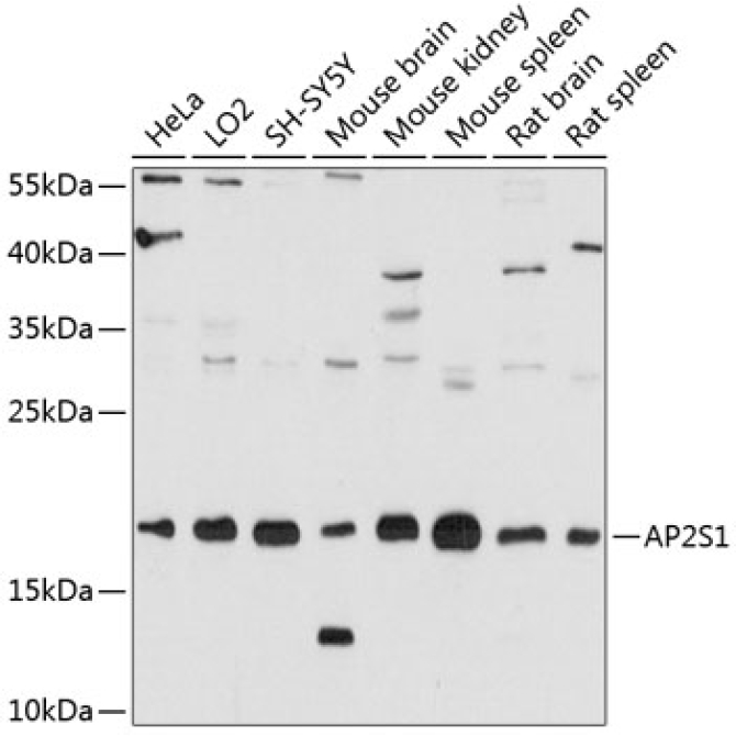 AP2S1 Rabbit Polyclonal Antibody