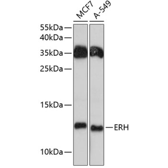 ERH Rabbit Polyclonal Antibody
