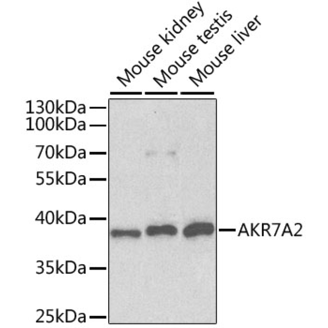 AKR7A2 Rabbit Polyclonal Antibody