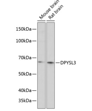 DPYSL3 Rabbit Polyclonal Antibody