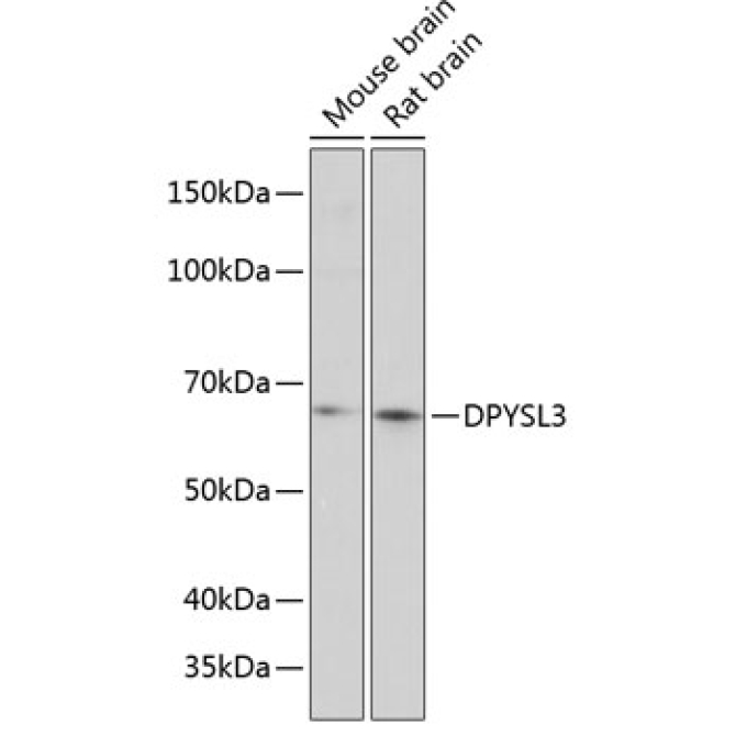 DPYSL3 Rabbit Polyclonal Antibody