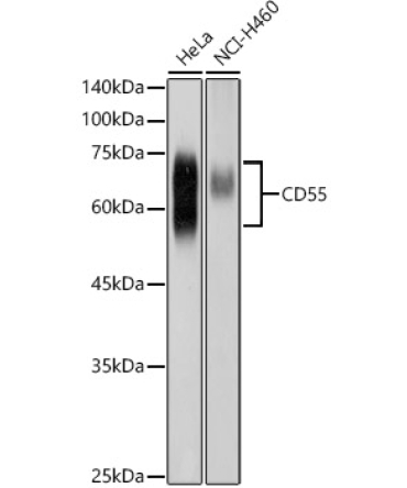 CD55 Rabbit Polyclonal Antibody
