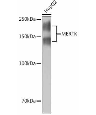MERTK Rabbit Monoclonal Antibody
