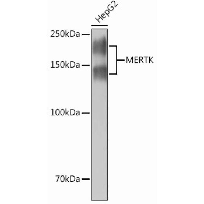 MERTK Rabbit Monoclonal Antibody