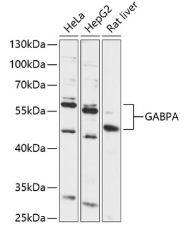 GABPA Rabbit Polyclonal Antibody