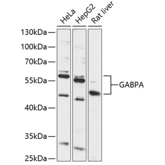 GABPA Rabbit Polyclonal Antibody