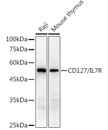 CD127/IL7R Rabbit Polyclonal Antibody