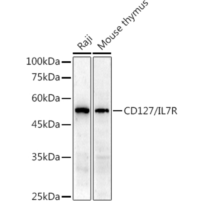 CD127/IL7R Rabbit Polyclonal Antibody