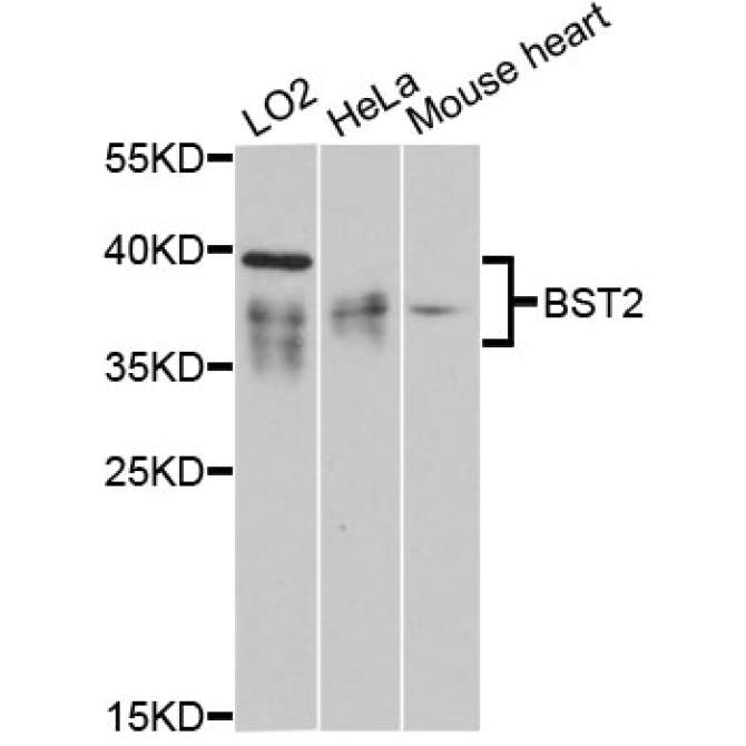 BST2 Rabbit Polyclonal Antibody