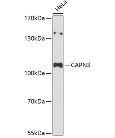 CAPN3 Rabbit Polyclonal Antibody