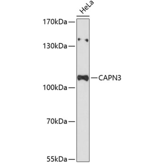 CAPN3 Rabbit Polyclonal Antibody
