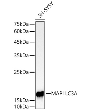 MAP1LC3A Rabbit Monoclonal Antibody