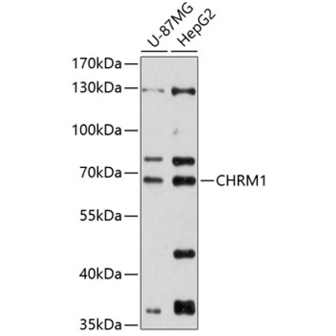 CHRM1 Rabbit Polyclonal Antibody