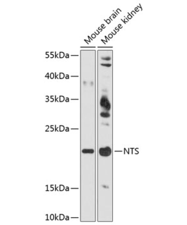 NTS Rabbit Polyclonal Antibody
