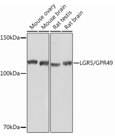 LGR5/GPR49 Rabbit Monoclonal Antibody
