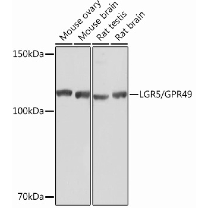 LGR5/GPR49 Rabbit Monoclonal Antibody