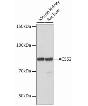 ACSS2 Rabbit Monoclonal Antibody
