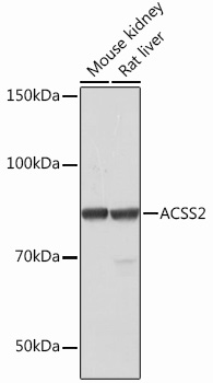 ACSS2 Rabbit Monoclonal Antibody