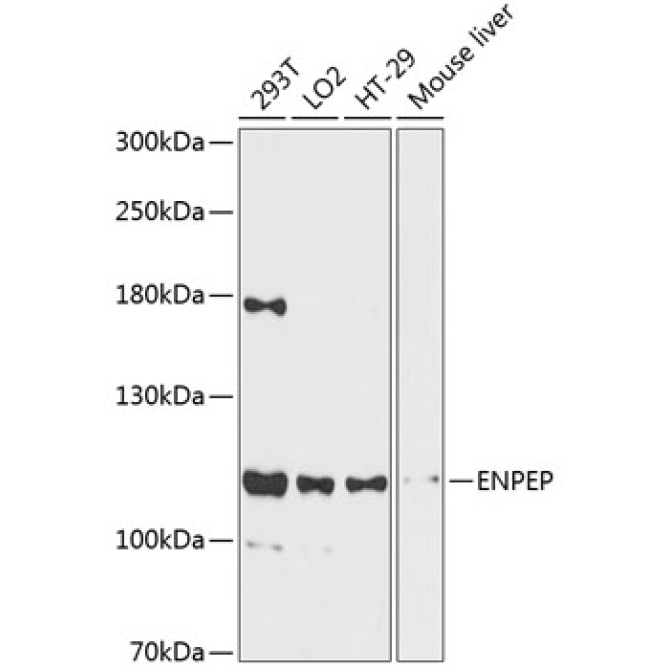 ENPEP Rabbit Polyclonal Antibody