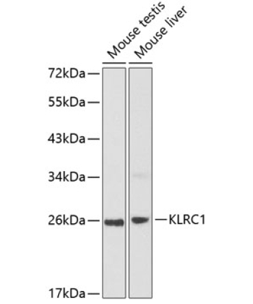 KLRC1 Rabbit Polyclonal Antibody