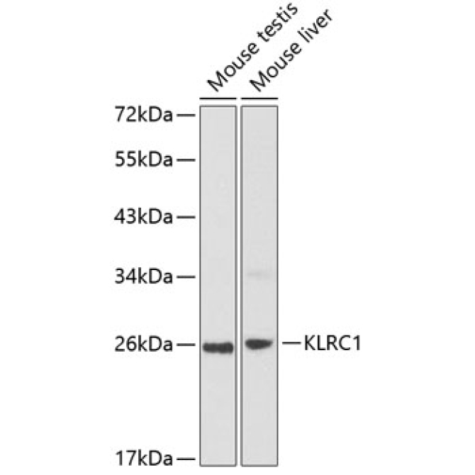 KLRC1 Rabbit Polyclonal Antibody