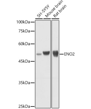 ENO2 Rabbit Polyclonal Antibody