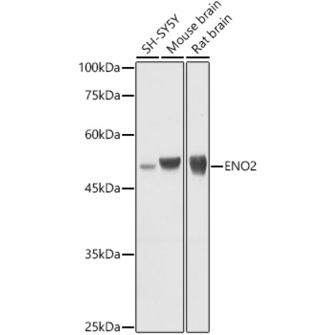ENO2 Rabbit Polyclonal Antibody