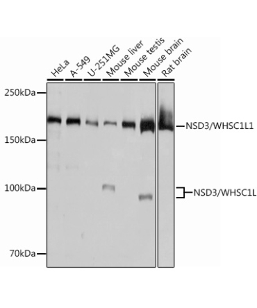 NSD3/WHSC1L1 Rabbit Monoclonal Antibody