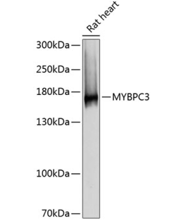 MYBPC3 Rabbit Polyclonal Antibody