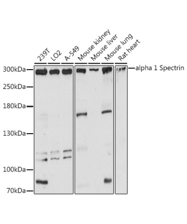 alpha 1 Spectrin Rabbit Polyclonal Antibody