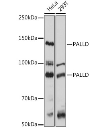PALLD Rabbit Polyclonal Antibody