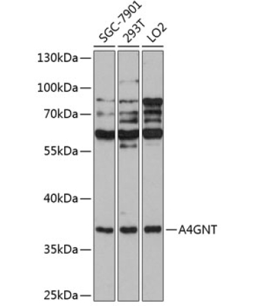 A4GNT Rabbit Polyclonal Antibody