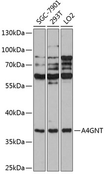 A4GNT Rabbit Polyclonal Antibody