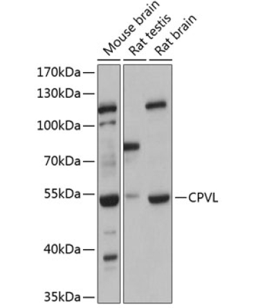 CPVL Rabbit Polyclonal Antibody