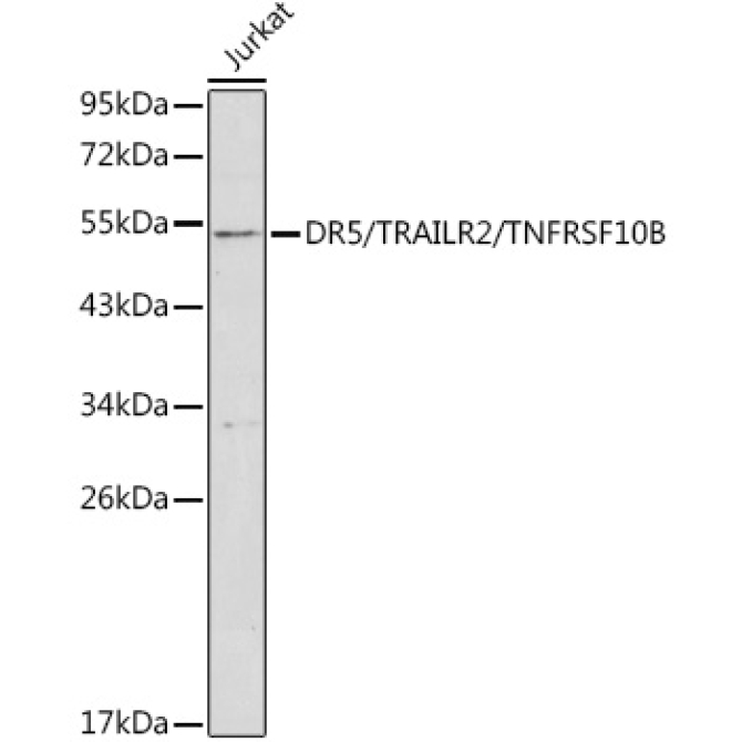 DR5/TRAILR2/TNFRSF10B Rabbit Polyclonal Antibody