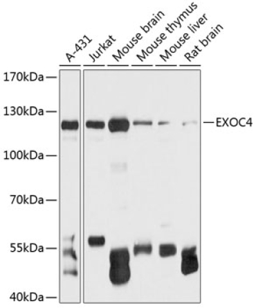 EXOC4 Rabbit Polyclonal Antibody