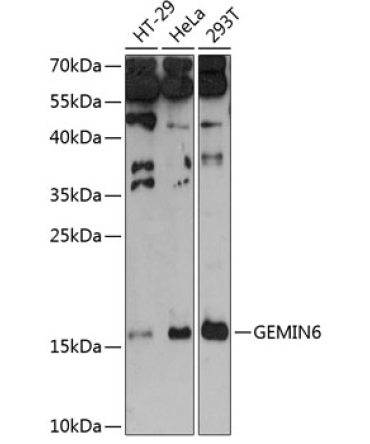 GEMIN6 Rabbit Polyclonal Antibody