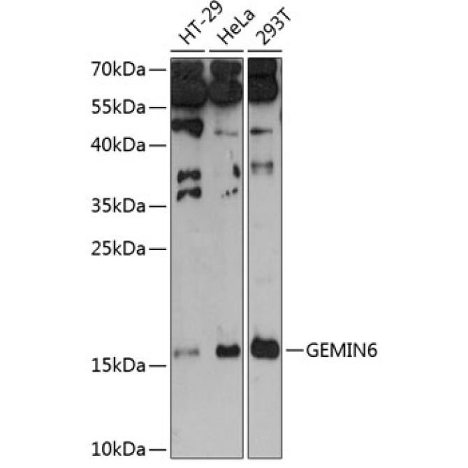 GEMIN6 Rabbit Polyclonal Antibody