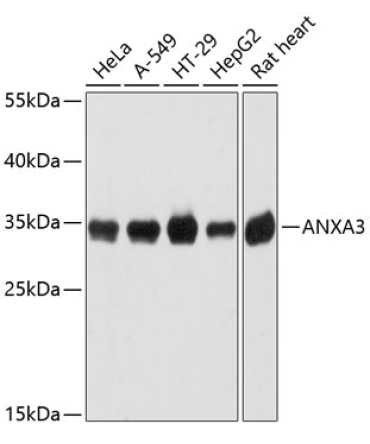 ANXA3 Rabbit Polyclonal Antibody
