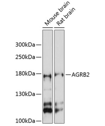 AGRB2 Rabbit Polyclonal Antibody