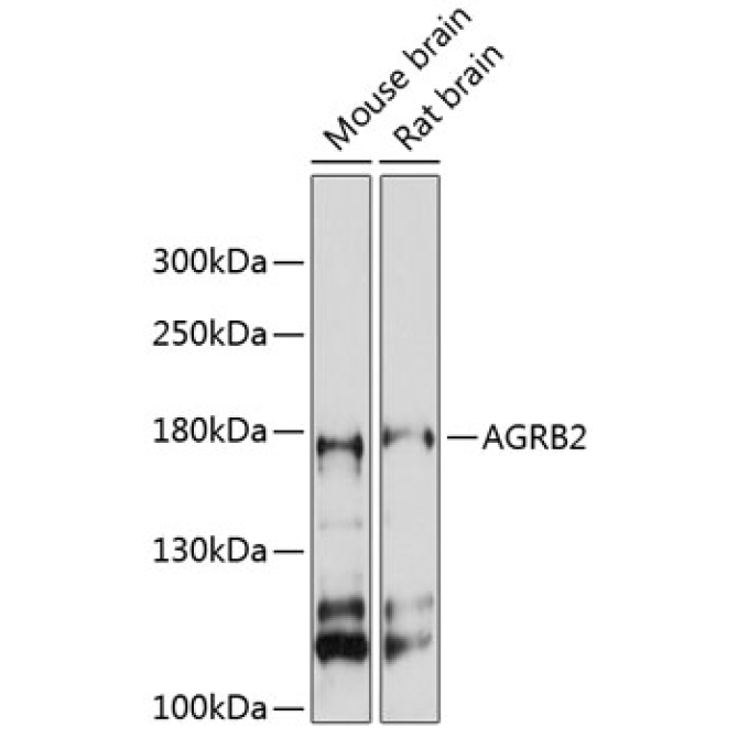AGRB2 Rabbit Polyclonal Antibody
