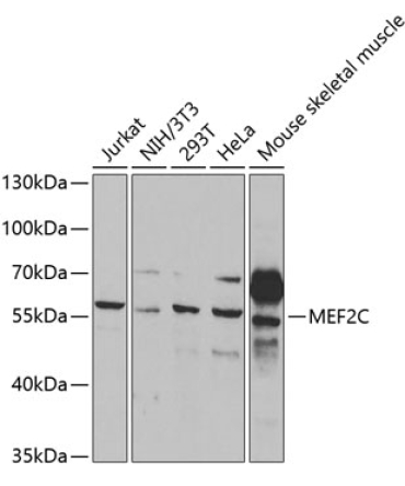 MEF2C Rabbit Polyclonal Antibody