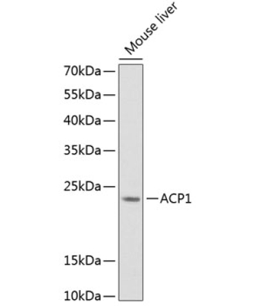 ACP1 Rabbit Polyclonal Antibody
